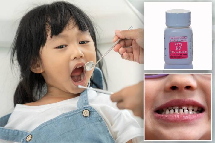 FDA restricts kids’ fluoride supplements over health risks