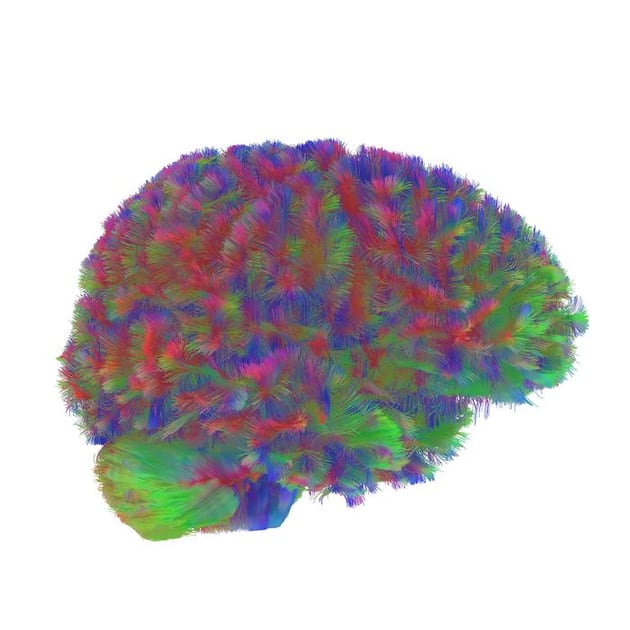 Study outlines critical turning points in brain development