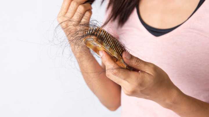 What to know about treatments for female hair loss or alopecia : NPR