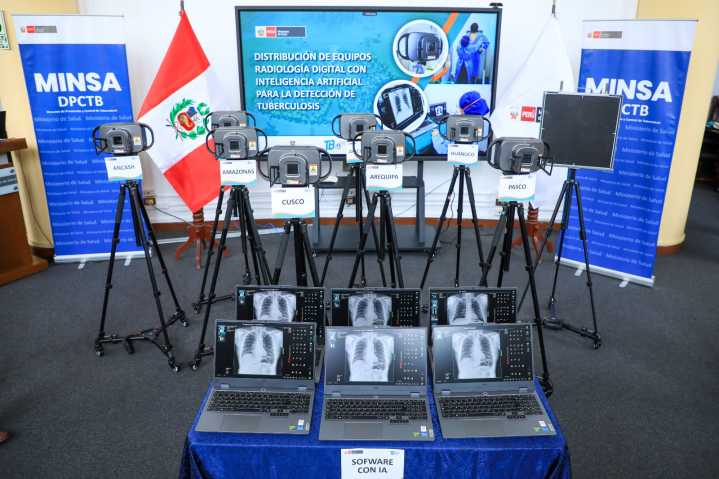 Minsa entrega equipos portátiles con inteligencia artificial para detección de tuberculosis en regiones