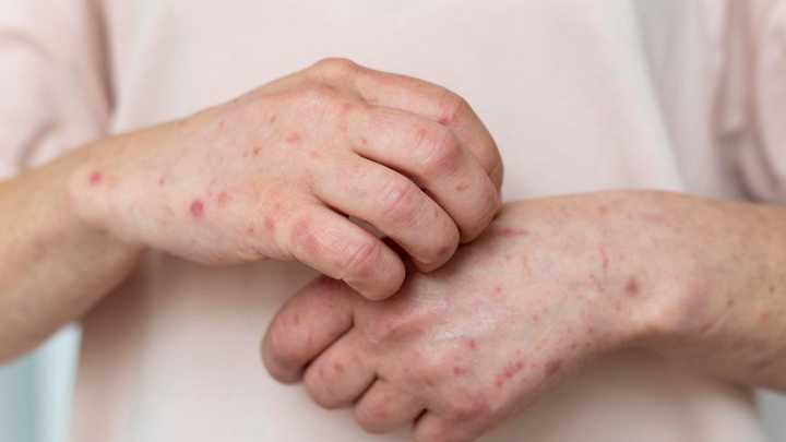 Uno por uno, los lugares de Jujuy por donde pasó el colectivo con sarampión