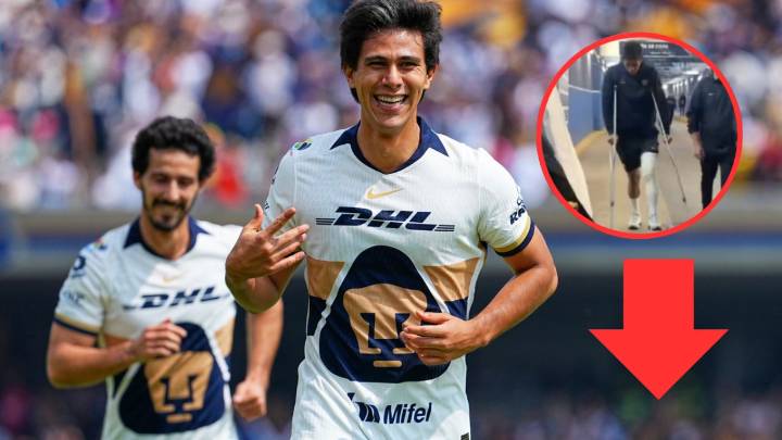 JJ Macías, baja por 9 meses en la Liga MX, ¿qué lesión presenta el delantero de Pumas?