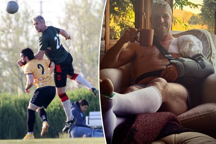 Ant Anstead reveals details of injuries he sustained while playing soccer