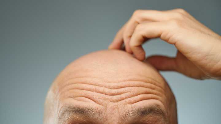 Baldness Breakthrough: Fat Cells Could Be The Secret to Rapid Hair Regrowth