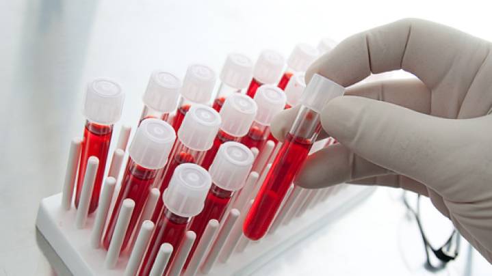 Un análisis de sangre podría detectar la demencia