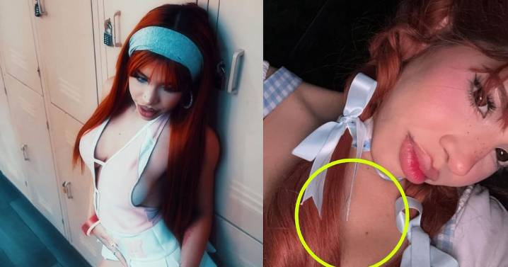 Yeri Mua confiesa tener terrible enfermedad en la piel ¿Es viruela del mono?