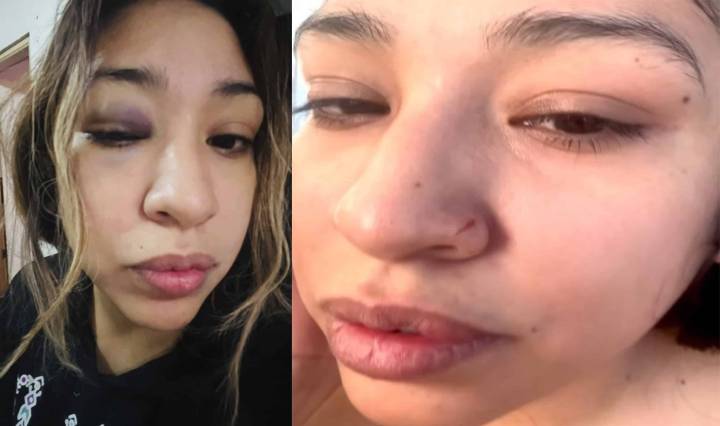 Mujer denuncia agresión física de su pareja ante la indiferencia de las autoridades