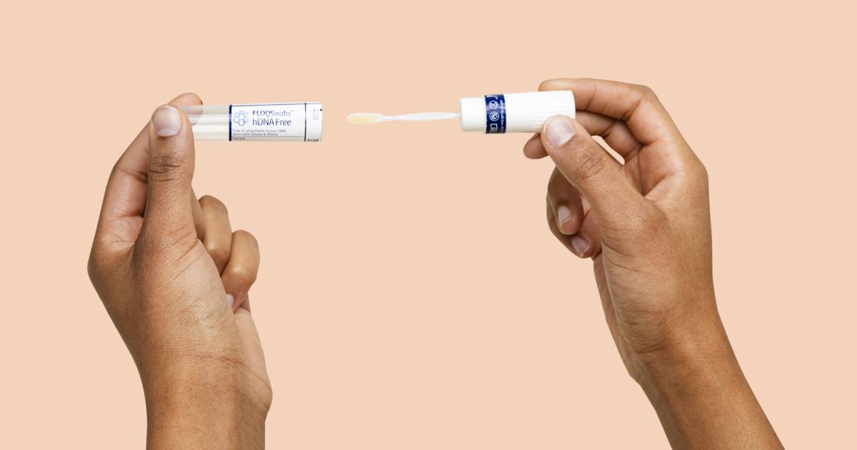 Gut microbiome tests are everywhere. Should you get one?