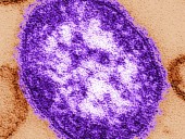 26 measles cases reported in B.C. in 1 week