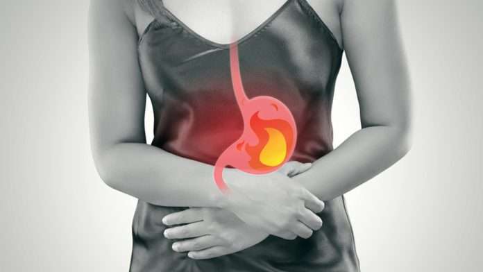 Mala alimentación produce reflujo