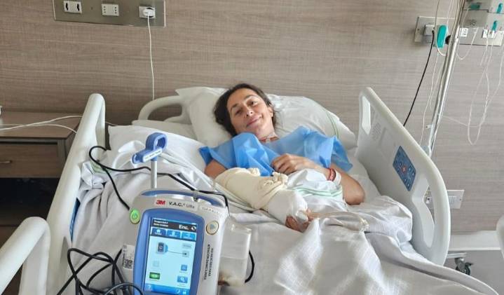 “Estuve a punto de perder el brazo”: el drama de deportista chilena que sufrió una picadura de araña de rincón