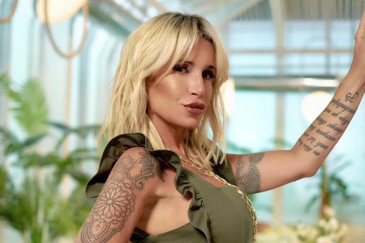 «En redes»: Florencia Peña mostró el paso a paso de su tratamiento dental y generó una ola de repercusiones