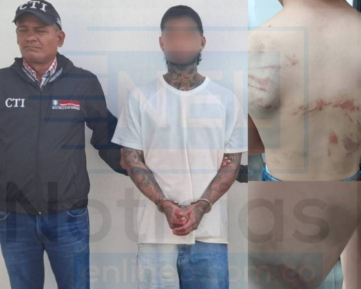 Sujeto que habría maltratado brutalmente a su hijo de 6 años con un ‘perrero’ fue judicializado