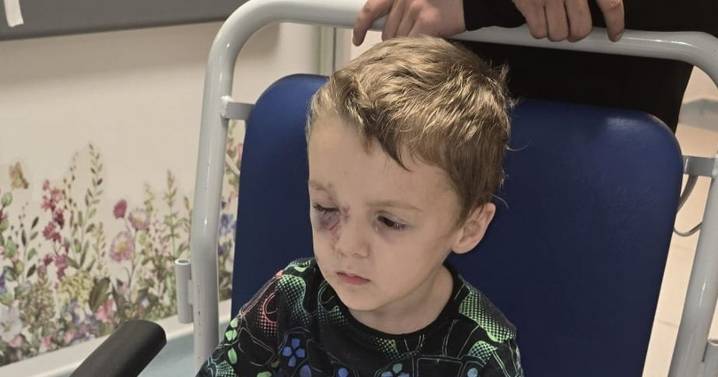 Autistic boy, 5, mauled by 'aggressive' dog in park screamed 'I'm going to die'