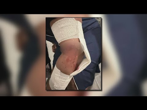 Woman attacked by dog in Riverdale