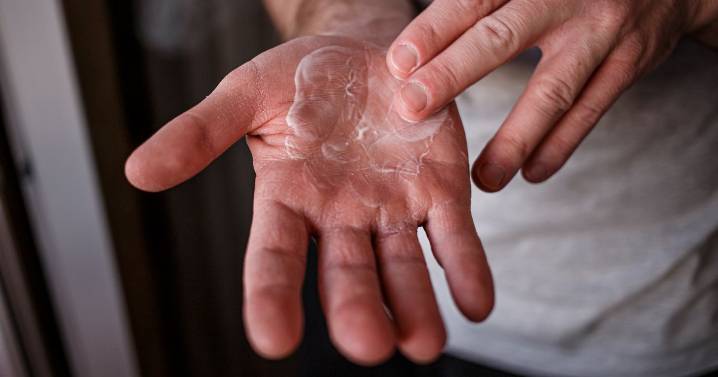 NHS hydrocortisone seven-day warning over common treatment