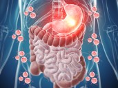 Día Internacional contra el cáncer neuroendocrino (NET); qué es y por qué se conmemora