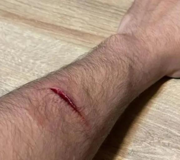 Un perro suelto atacó a un vecino en la plaza 14 de Octubre y buscan al dueño