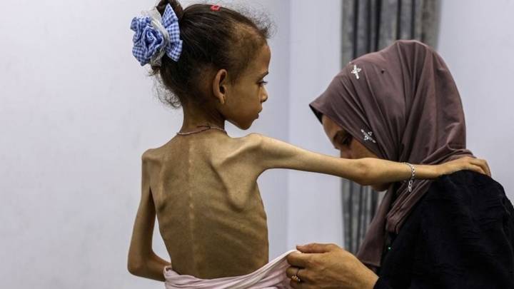 Hambre global en aumento: expertos alertan sobre sus consecuencias geopolíticas