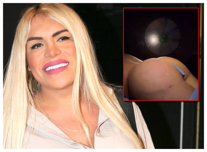 Wendy Guevara se hizo aumento de glúteos, así quedó