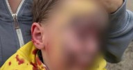 Boy, five, 'scarred for life' after being attacked by off