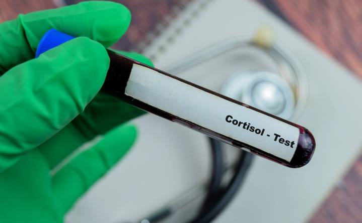 ¡La diferencia entre sentirte estresado y estar enfermo! Realízate una prueba de cortisol para saberlo