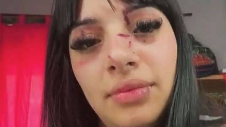 Fue brutalmente atacada a la salida de un boliche en Buenos Aires tras ser reconocida por sus videos de TikTok