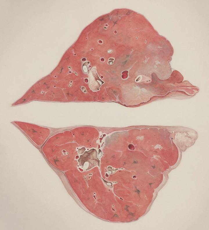 Dangerous Recall After Food Made In New York Found With Organs