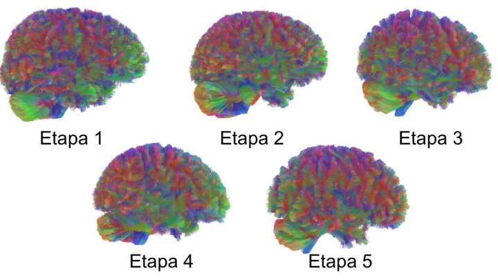 Las cinco etapas del cerebro humano: las edades exactas, de la infancia a la vejez, en las que el órgano sufre importantes cambios