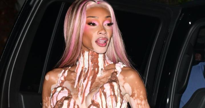 Winnie Harlow Wows Fans in Ice Cream Costume