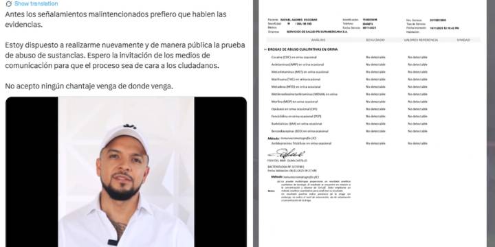 Concejal Andrés Escobar afirmó que está dispuesto a realizarse prueba de abuso de sustancias públicamente: “De cara a los ciudadanos”