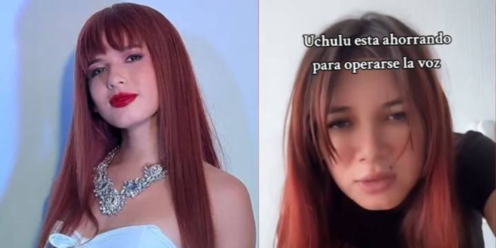 La Uchulú revela el exorbitante monto que costará su operación de cambio de voz