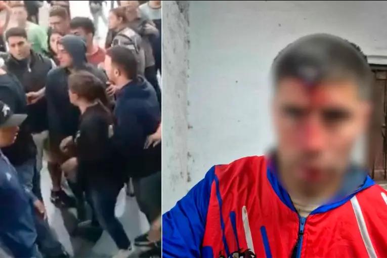 Exfutbolista fue apuñalado en el cráneo con una llave de auto en partido de fútbol: lo operaron