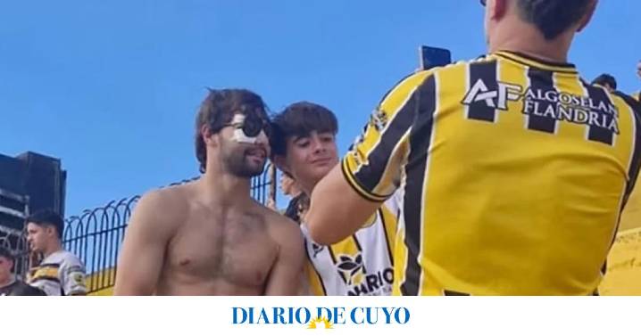 Santiago Sosa mostró cómo quedó su rostro tras la operación por la fractura que sufrió por un golpe de Marcos Rojo