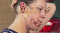 'I don't want to die in front of my kids': Arizona woman describes violent dog attack