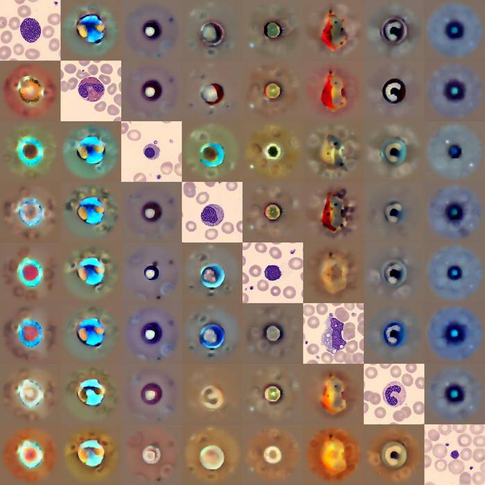 Generative AI Spots Abnormal Blood Cells Better than Experts