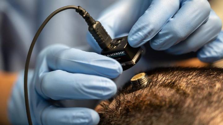 What are the new UNESCO recommendations for neurotechnology use?