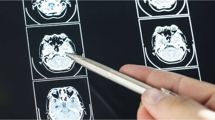 La adolescencia dura hasta los 30 años: un estudio aseguró que existen cuatro edades "clave" para el cerebro