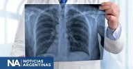 Día Mundial del Cáncer de Pulmón: alertan sobre el aumento de casos