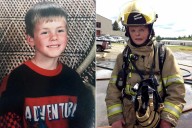 Burn Survivor Recalls Watching His Face 'Slide Off' in Reflection (Exclusive)