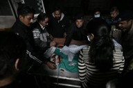 Man throws acid on wife in Mandi, accused arrested; victim shifted to AIIMS Bilaspur