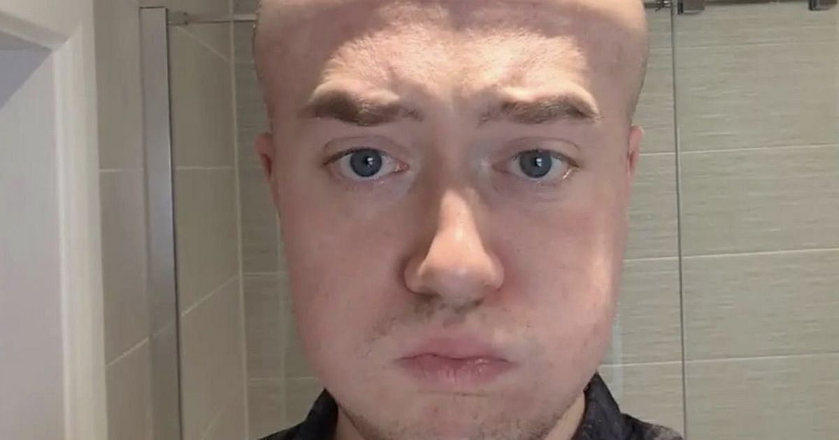 'This procedure cost me £3,500 and it made me look like Megamind'