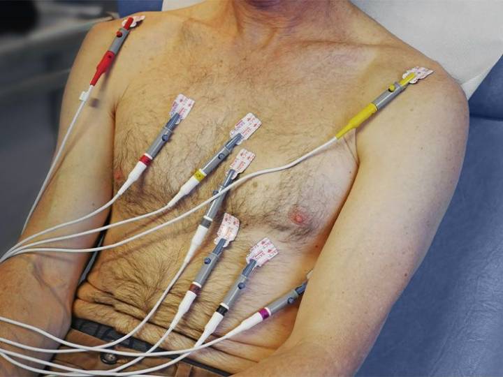 Dementia: Biomarker of heart damage may raise risk by 38%