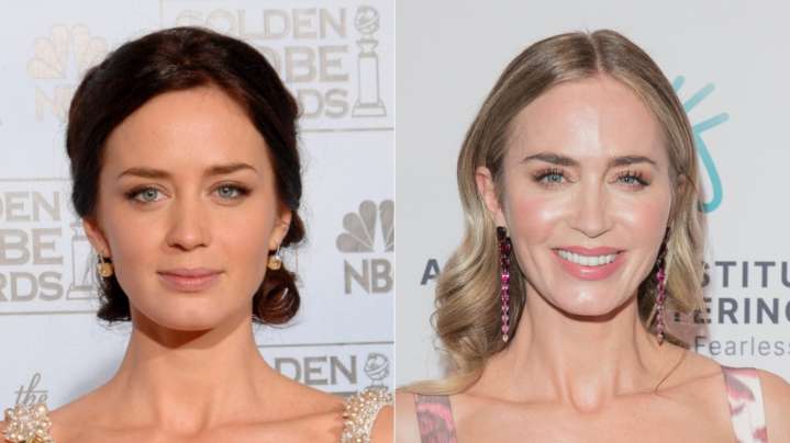 How Emily Blunt's Face Has Transformed Over The Years, According To Our Plastic Surgeon