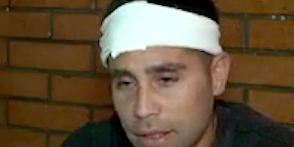 “Por suerte la puedo contar”: habló el futbolista del Ascenso al que le clavaron una llave en la cabeza