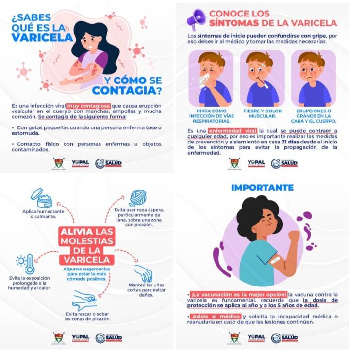 Medidas preventivas frente a casos sospechosos o confirmados de varicela en Yopal
