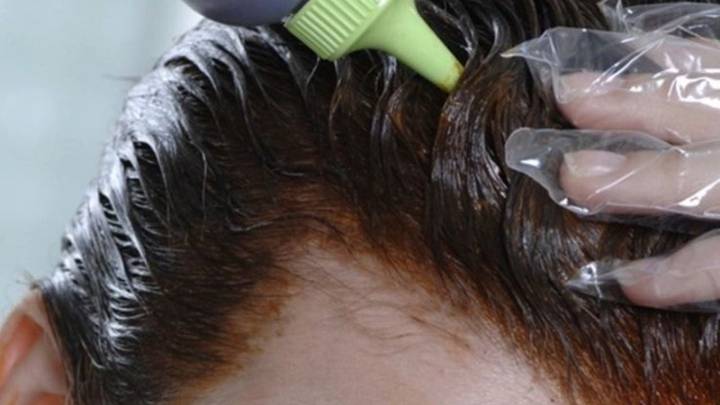 Cómo quitar el tinte de la piel rápido y sin irritar: trucos seguros para después de teñirte el cabello