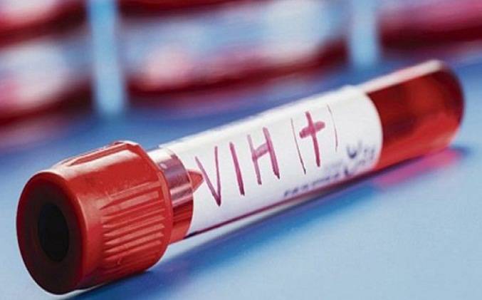 Diagnóstico tardío del VIH amenaza fin del SIDA en Europa