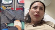 Perro mordió a Gaby Ramírez y pasó horas con la herida abierta: "Mi pierna está destrozada"