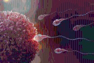 La IA logra el primer embarazo confirmado usando espermatozoides «invisibles»